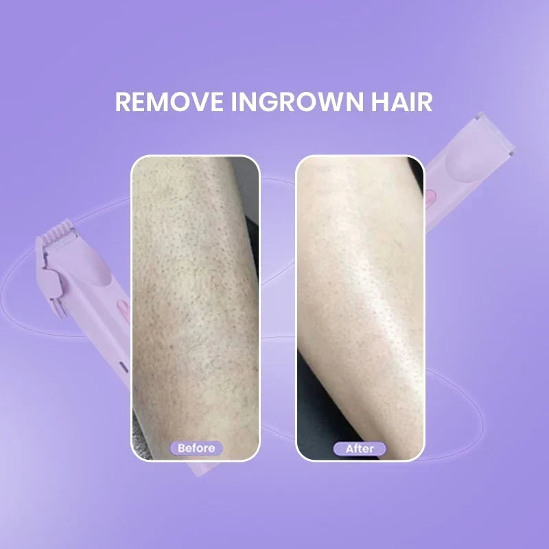 SmoothSilk™ 2-in-1 Hair Remover & Shaver – For Face, Body & Bikini Zone